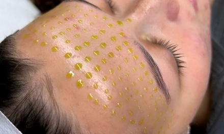 1 BioRePeel Chemical Peel - Astria Aesthetics