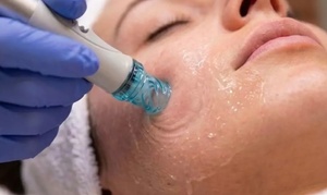 Hydradermabrasion with Salmon DNA Peptides, LED Therapy, and Oxygen Therapy