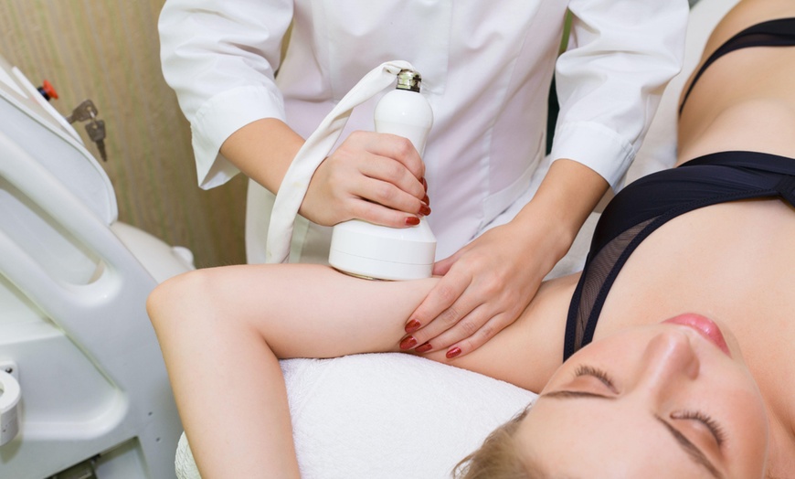 Image 7: Non-Invasive Cryo-Lipo Treatment for Stubborn Areas