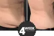 Up to 34% Off on Fat Reduction - Non-Branded at Core Definition - Second Medium