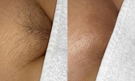 One Brazilian Waxing - Untamed Radiance