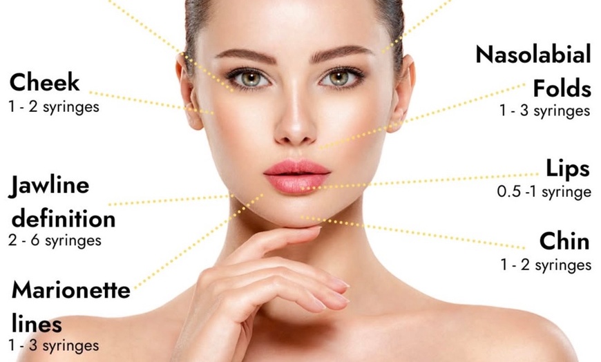 Image 5: Enhance  with Half / Full Syringe of Lip Filler or LIQUID FACELIFT 