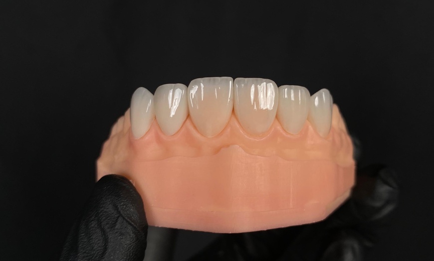 Image 3: Dental Crowns, Dental Exam, X-rays & Cleaning, Dentures & More