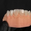 Image 3: Dental Crowns, Dental Exam, X-rays & Cleaning, Dentures & More