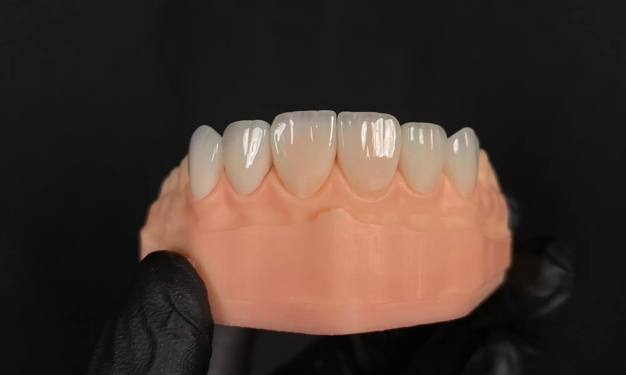 Dental Crowns, Dental Exam, X-rays & Cleaning, Dentures & More