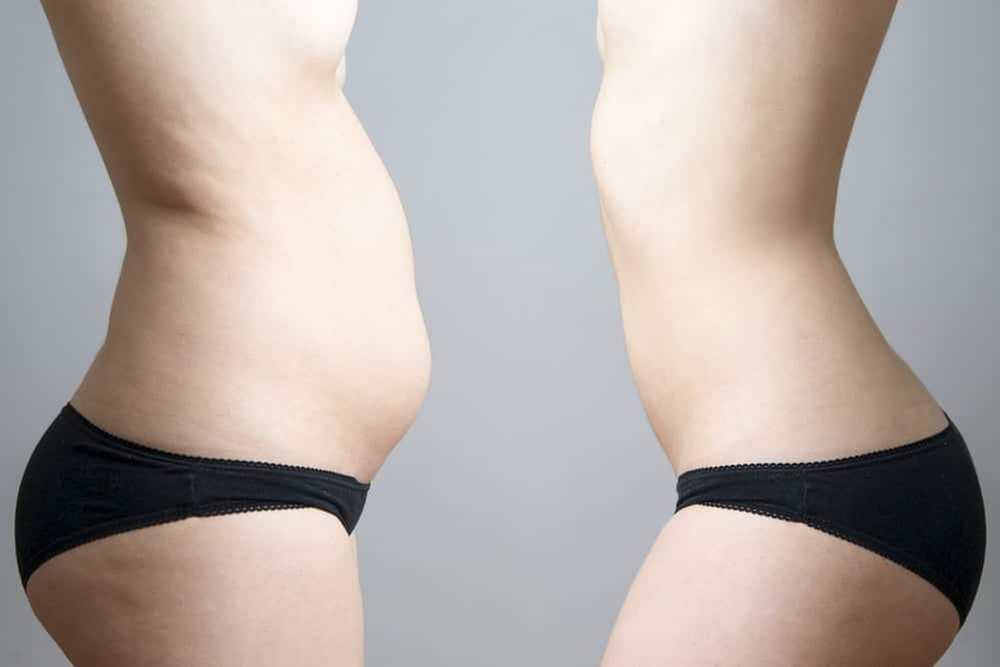 Up to 77% Off Laser Lipo & Cavitation Packages JR Astoria Nails & Spa