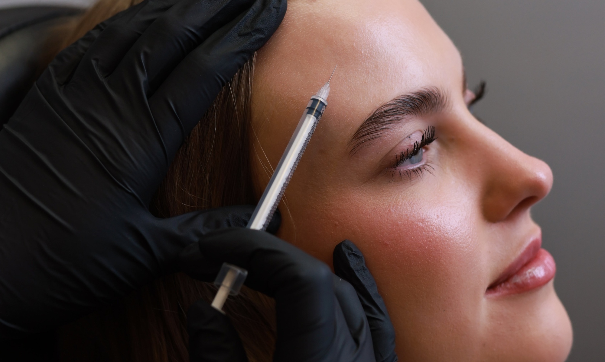 Up to 54% Off on Injection - Botox at Skin Era