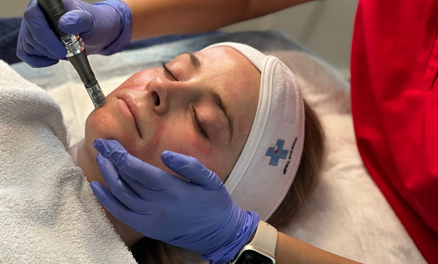 Image 1: Up to 37% Off on Micro-Needling at Make You Well Family Practice & Aesthetics