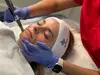 Experience revitalizing micro-needling and PRP facials at Make You Well Family Practice & Aesthetics, offering up to 45% off.