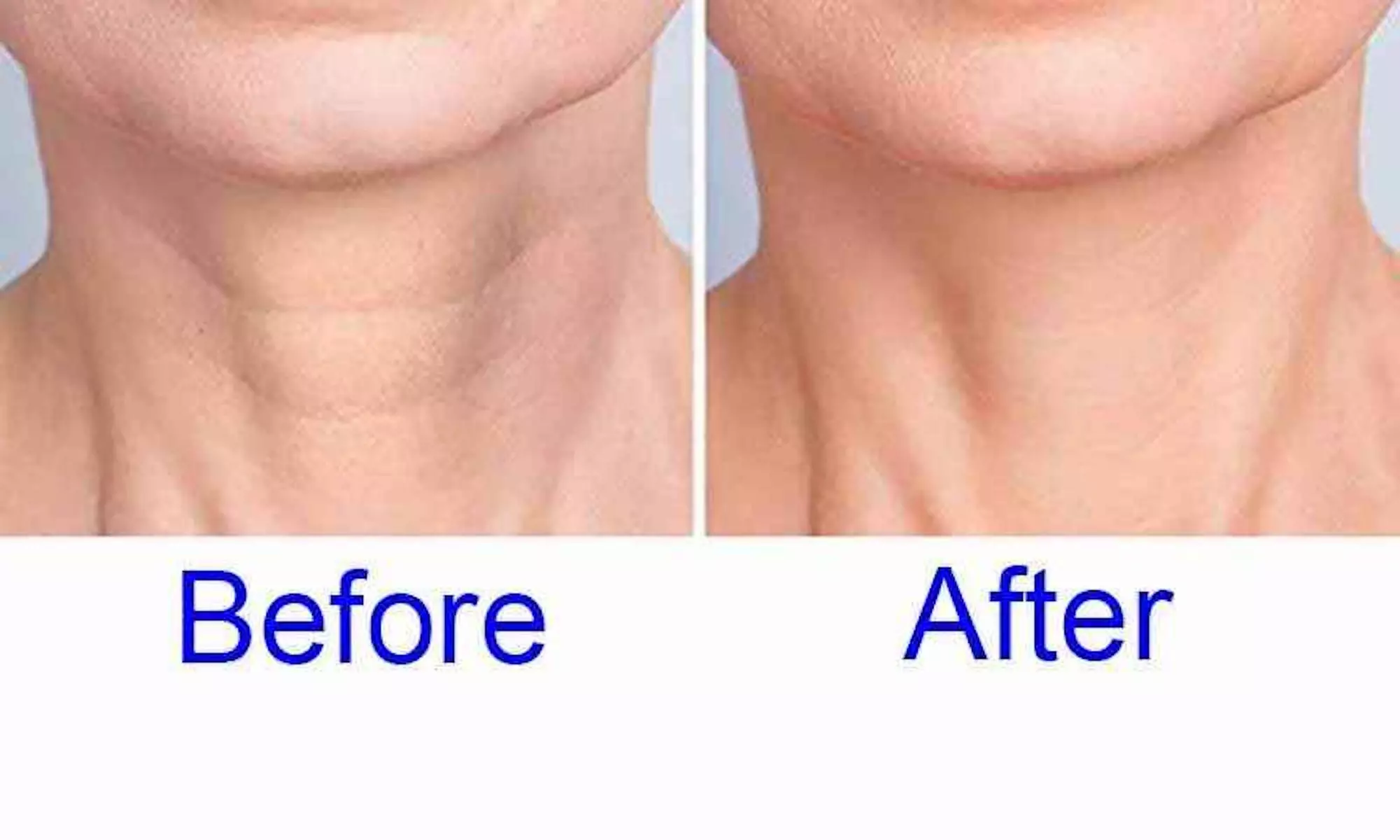 Up to 55% Off on Facial - Anti-Ageing at United Kingdom