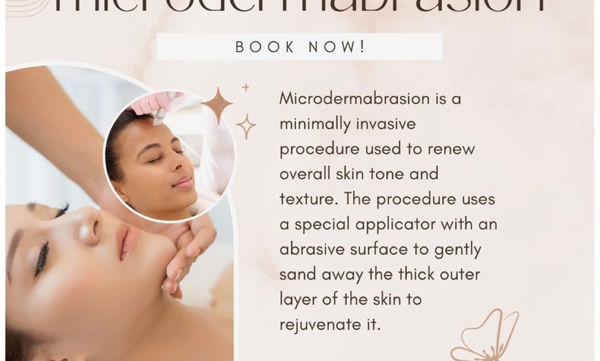 Image 1: One or Three Sessions of Diamond Dermabrasion Skin Peeling Sessions