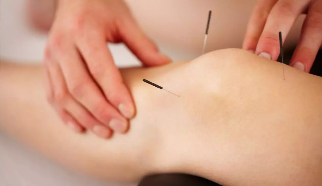 90-Minute Acupuncture w/ Consultation at Paramount Wellness
