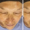 Image 3: Up to 31% Off on HydraFacial at Phoenix Esthetics of CT