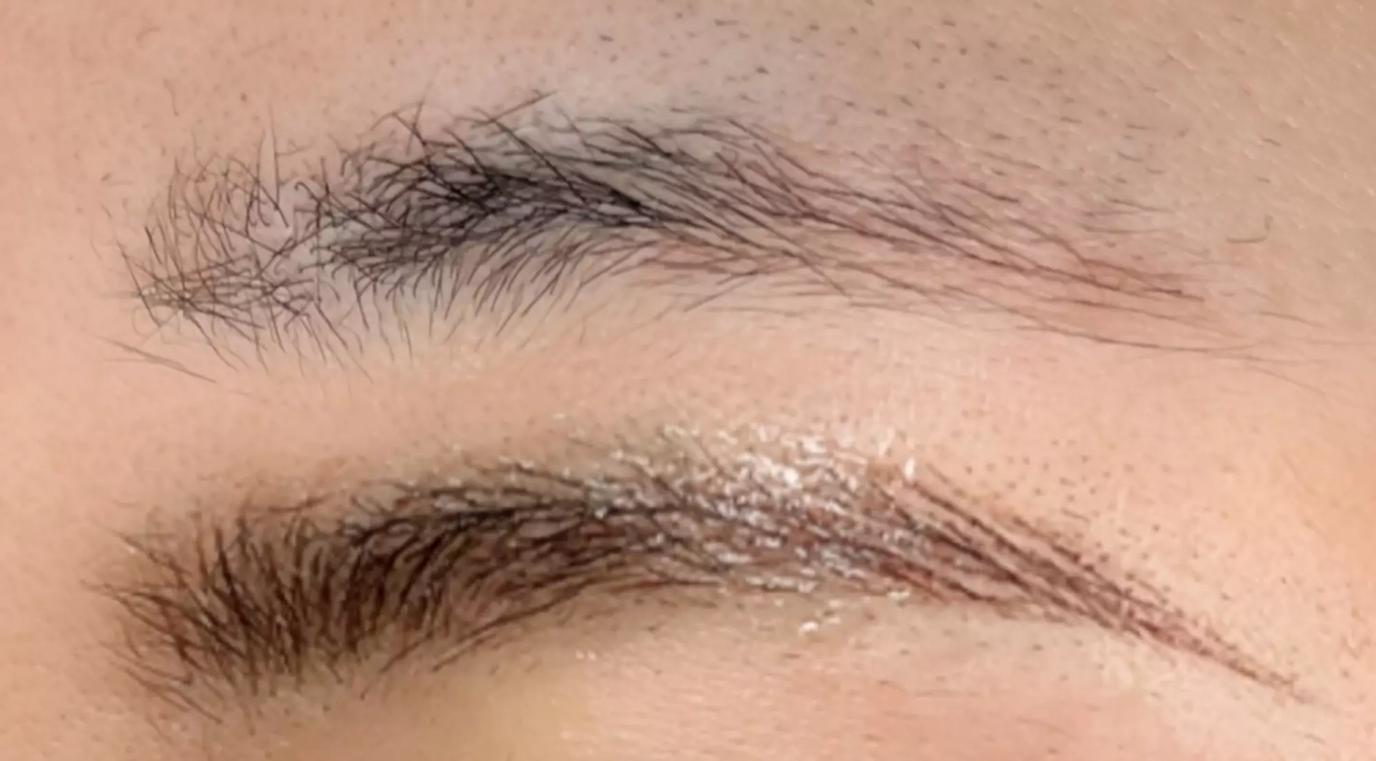 Brow Restoration & Volume Fill Enhancement Session