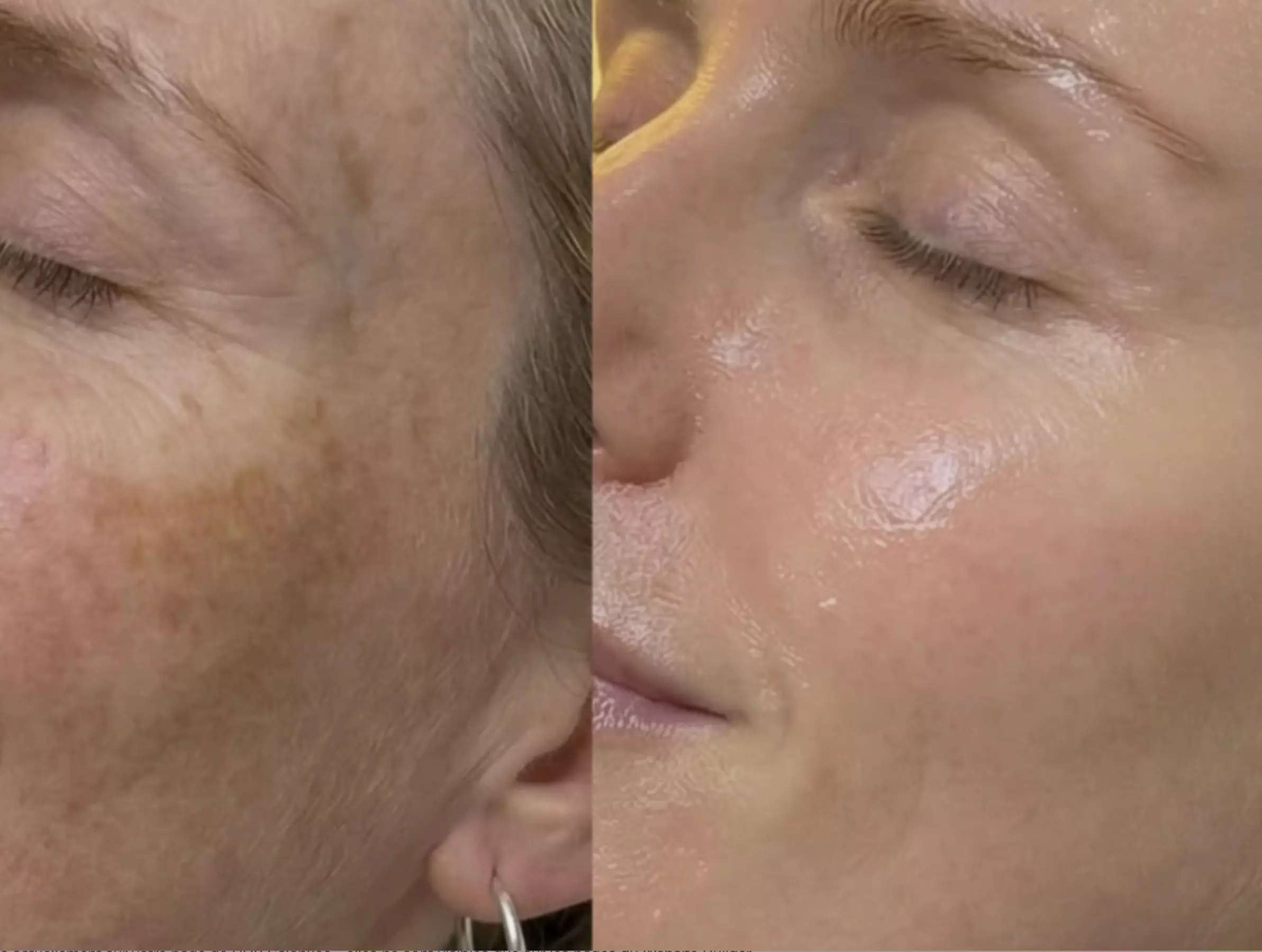 Unifiez votre teint avec un soin anti-taches ciblé 5G Removal