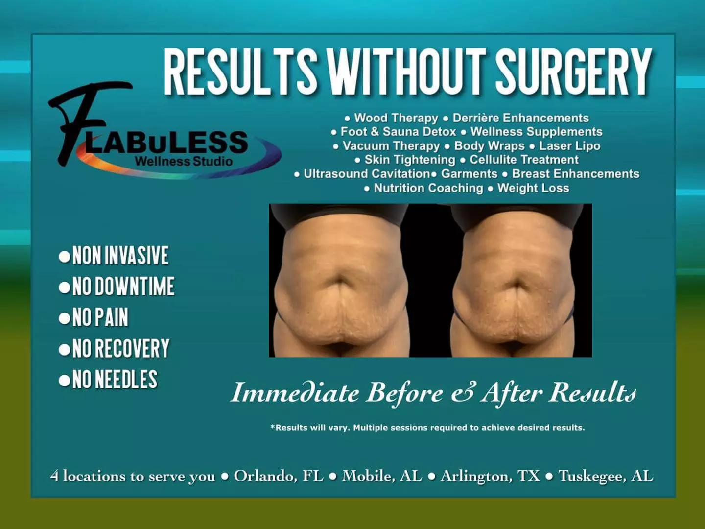 Up to 51% Off on Needle-Free Fat Dissolve Infusion at Flabuless Wellness Studio - Arlington - Second Medium