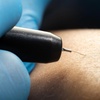 Image 3: 15- or 30-Minute Electrolysis Sessions for Hair Reduction