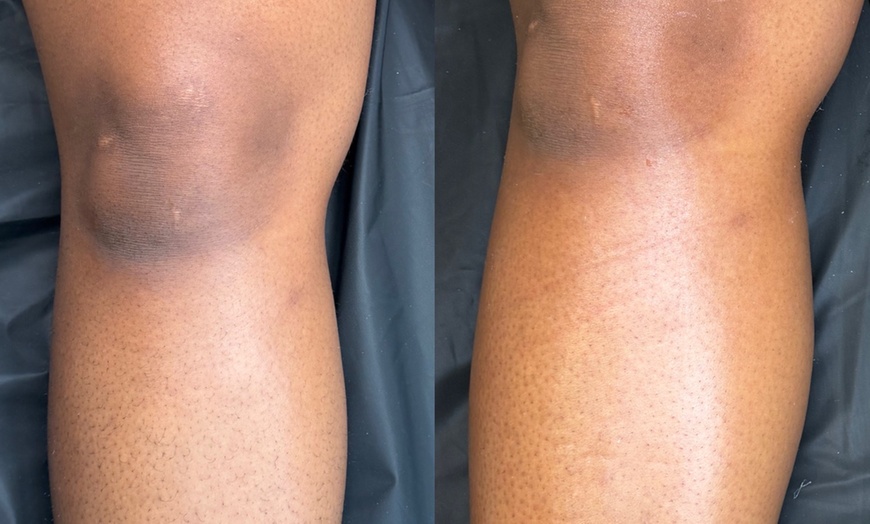 Image 2: Women’s Brazilian, Back & Full Leg Waxing for Smooth Skin