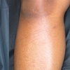 Image 2: Women’s Brazilian, Back & Full Leg Waxing for Smooth Skin