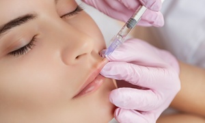 Up to 53% Off Juvederm Injections at Faces Med Spa