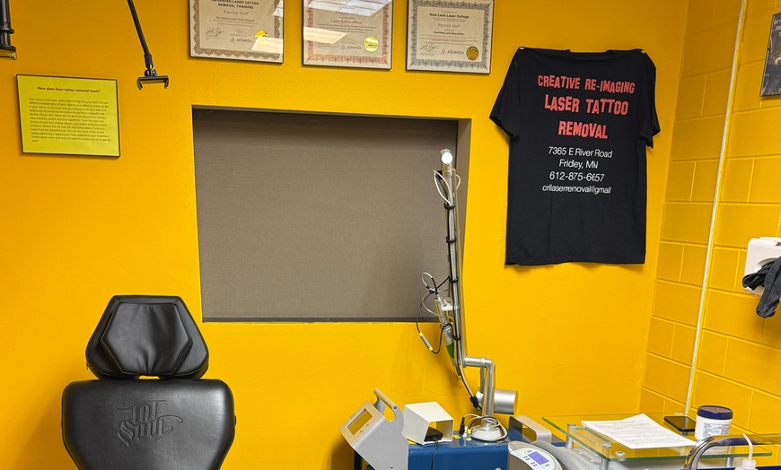 Image 3: Laser Tattoo Removal Sessions for Various Sizes