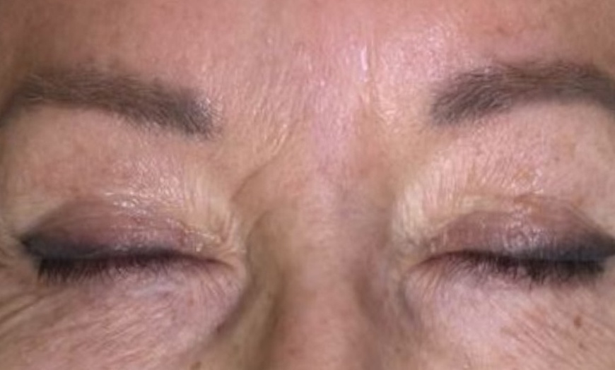 Image 5: Achieve Ink-Free Skin with Laser by Nicole's Tattoo Removal for All Sizes up to 39%