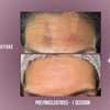 Image 7: Polynucleotides Regenerative Treatment at Divine Aesthetics in London