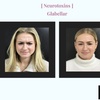 Image 4: Up to 39% Off on Botox at SlimmThicc Aesthetics Spa
