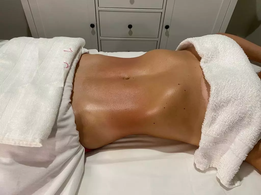 60- or 90-Minute Lymphatic Body Shape with Wood and Endermotherapy at Riocali Recovery Center (Up to 50% Off) - Primary Image