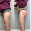 Image 1: Boost Your Confidence with 30, 60, or 90-Minute Non-Invasive Butt Lift