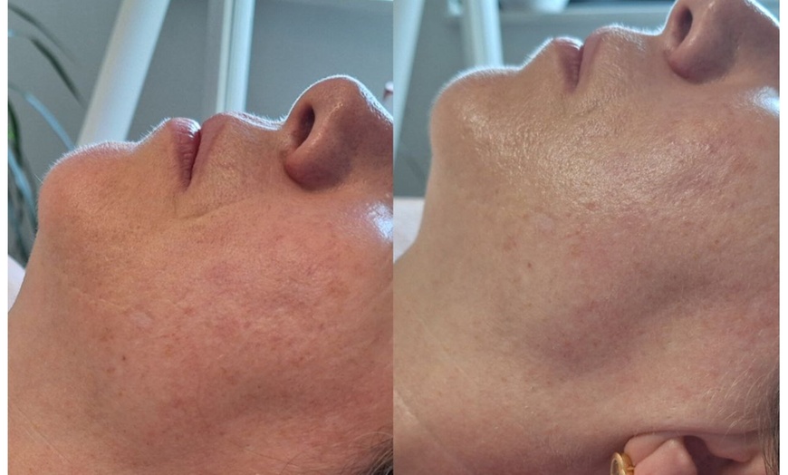 Image 8: Bis zu 35% Rabatt auf den Massage – Aromaöl bei Gym for skin Kosmetiksalon