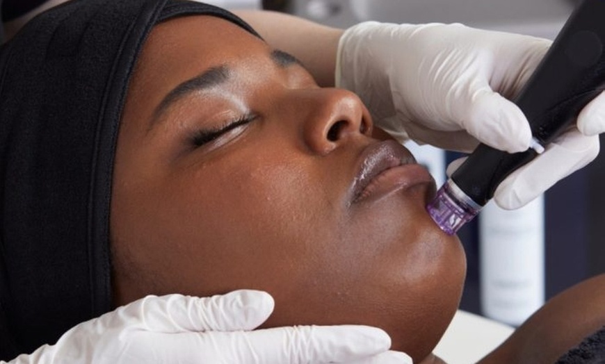 Image 2: Een stralende huid: Hydraface-behandeling van 60 minuten