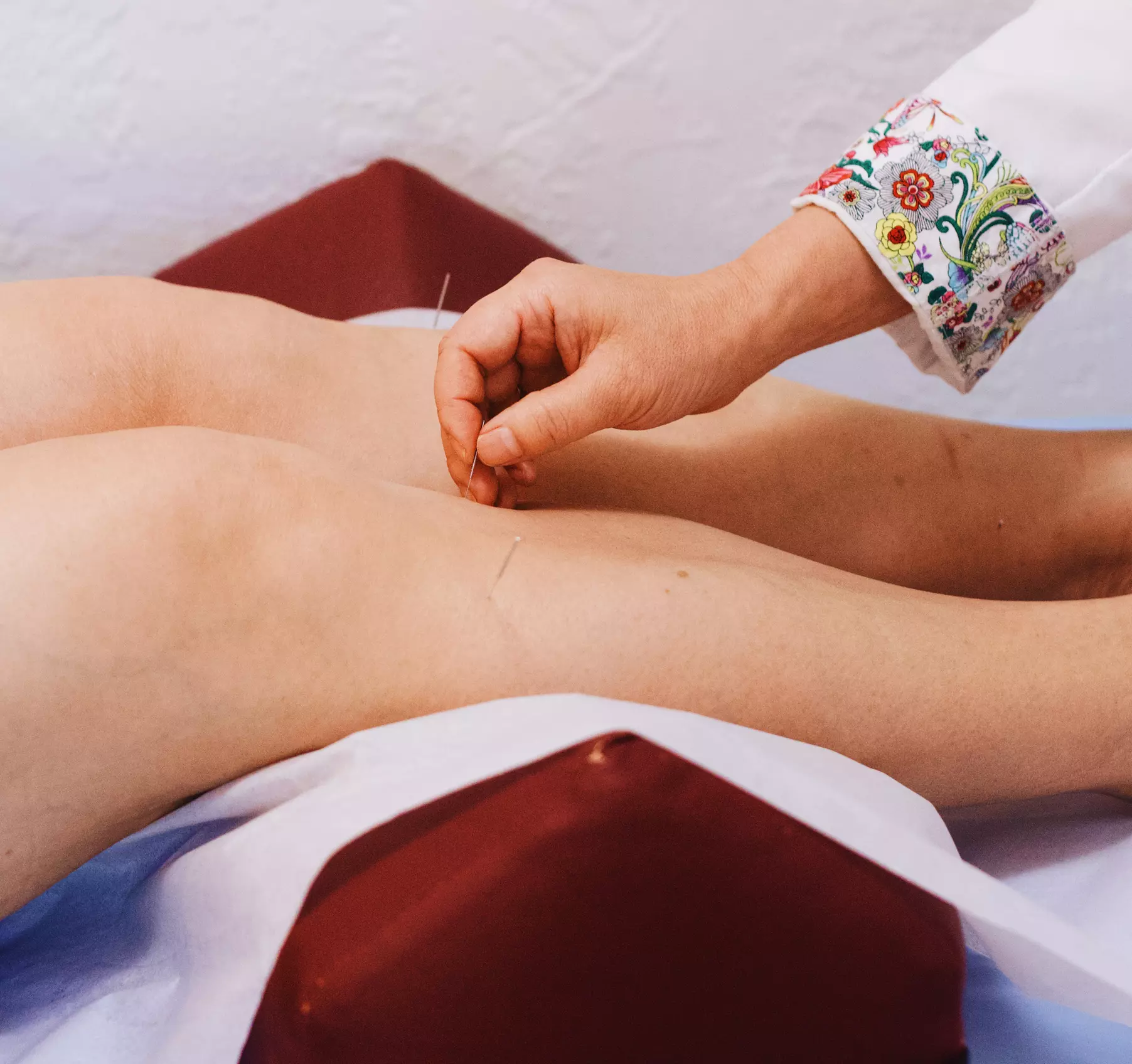 Rejuvenate Your Body: Cryotherapy, Acupuncture and More