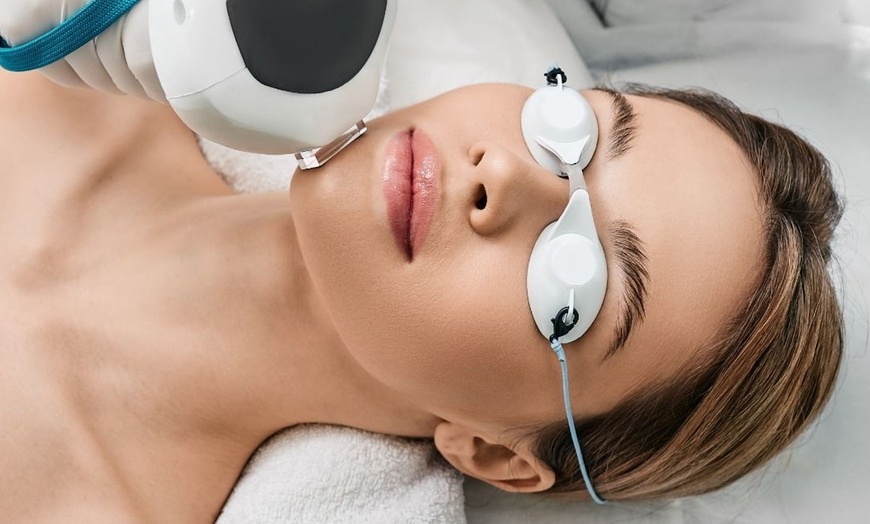 Image 3: Transform Your Skin with One or Three Full-Face Laser Resurfacing