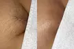 Up to 50% Off on Waxing at Untamed Radiance - Second Medium