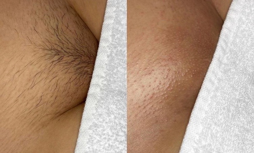 Image 2: Up to 50% Off on Waxing at Untamed Radiance