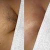 Image 2: Up to 56% Off on Waxing at Untamed Radiance