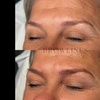 Image 7: Glow Up with One Microblading Session - Optional Top-Up Available