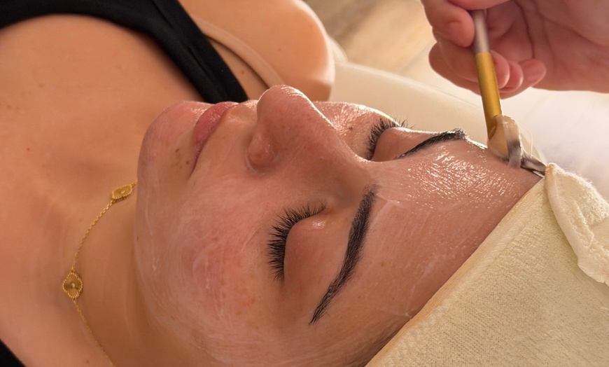 Image 3: Up to 40% Off on Facial at Skin Society Medical Spa