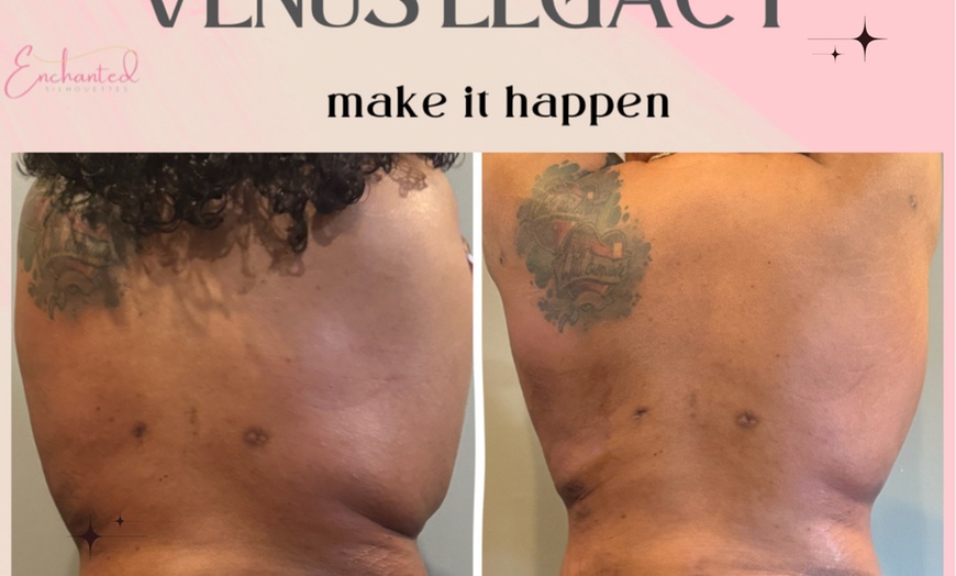 Image 1: Up to 50% Off on Lipo - Non-Invasive Laser-iLipo at Enchanted Curves @ Zenfultouch