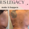 Image 1: Up to 40% Off on Lipo - Non-Invasive Laser-iLipo at Enchanted Curves @ Zenfultouch