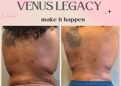 20 Min 1 Area VENUS LEGACY treatment - Enchanted Curves @ Zenfultouch