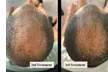 Unlock Your Hair's Potential: One or Three PRP Hair Restoration Sessions at Wharf Aesthetics ( Up to 77% Off ) - Second Medium