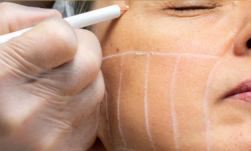 Image 6: Tratamiento HIFU avanzado para tensado facial y corporal no invasivo