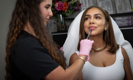 One Syringe of Lip Filler - Age Management Optimal Wellness