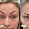 Image 5: Up to 65% Off on Injection - Botox at Nude Aesthetics