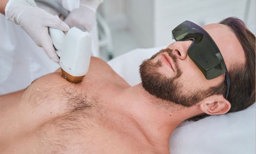 Image 2: 5 séances d'épilation laser pour femme ou homme sur petite, moyenne ou grande zone (jusqu'à 50% de remise)
