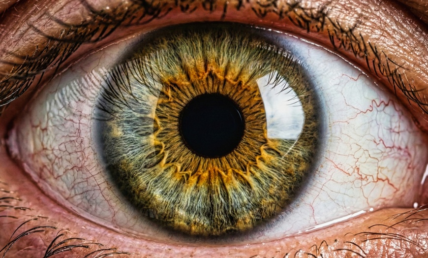 Image 2: Bildbearbeitung für dein Iris-Foto für 1, 2 oder 3 Personen