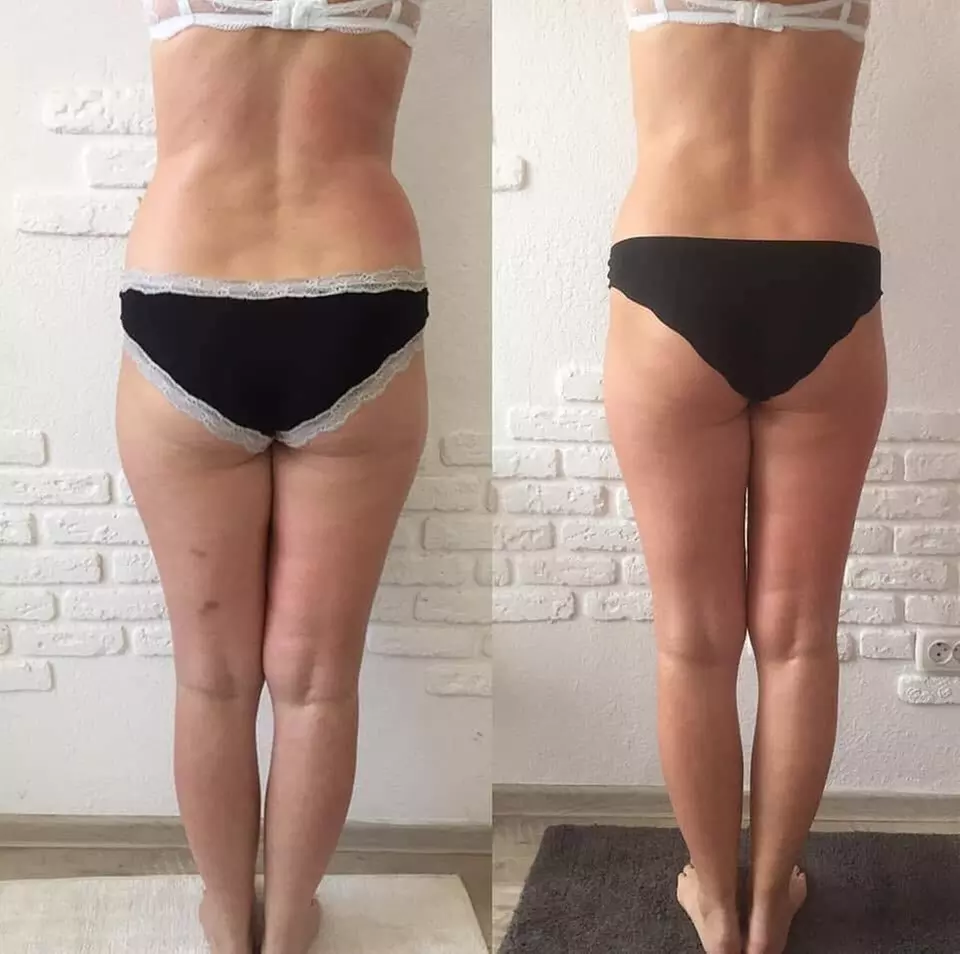 Odkryj nowoczesny zabieg EMS dla poprawy sylwetki: 2, 4 lub 8 sesji dla 1 osoby (do -73%) - Primary Image