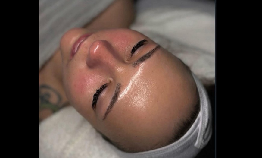 Image 2: Revitalize Your Skin with upto Three 90-minute Hydrafacials Sessions